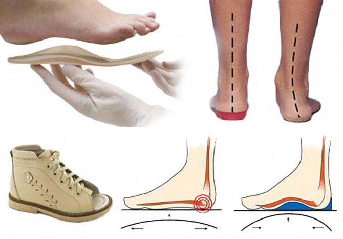Пошив ортопедической обуви. Минск - изображение 1